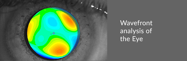 Wavefront analysis of the eye