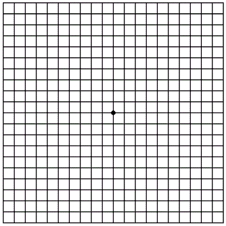 The Amsler Grid